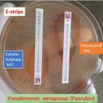MIC of Polymixin B and Colistin sulphate determination on Pseudomonas