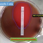 MIC of penicillin determination on Streptococcus pneumoniae