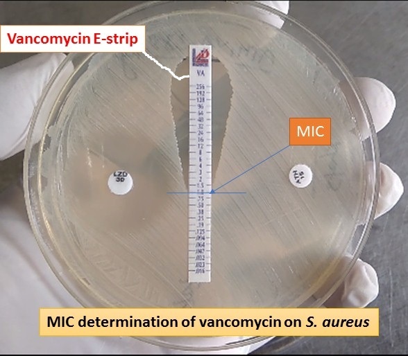 MIC of vancomycin on Staphylococcus aureus for VRSA determination
