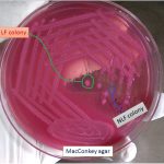 MacConkey agar