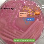 MacConkey with various bacterial colonies