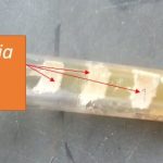 Malassezia on SDA