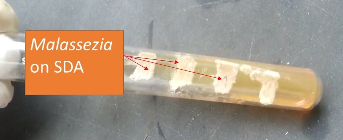 Malassezia on SDA