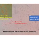 Microsporum persicolor in LPCB mount has  microconidia. Microconidia  are abundant, spherical to pyriform where as macroconidia  thin walled, cigar shaped , four to seven celled  having size of 40-60 × 6-8 µm (rarely produced)   lacking as shown above image.