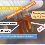 Motility of bacteria
