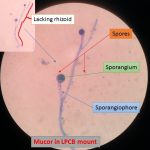 Mucor and its structures in LPCB