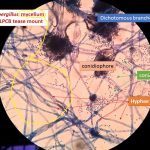 Mycelium