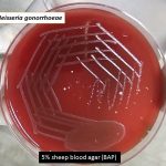 Neisseria on blood agar