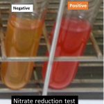 Nitrate reduction test