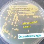 Nutrient agar