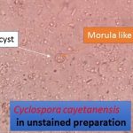 Oocyst of Cyclospora