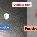 Oxidase test
