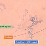 Penicillium in LPCB mount