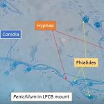 Penicillium species in LPCB mount