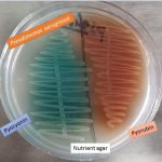 Pigment of Pseudomonas