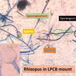 Rhizopus in LPCB mount with its various structures
