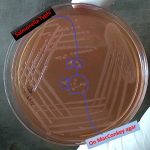 Salmonella on MacConkey agar