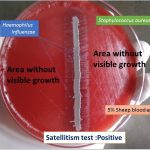 Satellitism test for the identification of Haemophilus influenzae