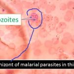 Schizont of malarial parasite