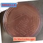 Shigella on MacConkey agar