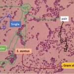 Staphylococcus aureus in single, pairs and clusters
