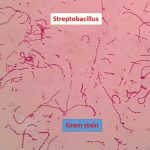 Streptobacillus