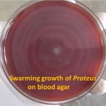 Swarming growth of Proteus