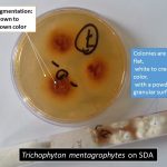 Trichophyton mentagrophyte on SDA