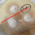 Trichophyton mentagrophytes colony characteristics on SDA