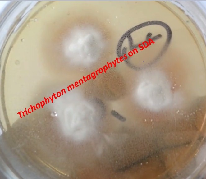 Trichophyton mentagrophytes colony characteristics on SDA