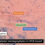 Trichophyton mentagrophytes in LPCB mount