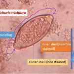 egg of Trichuris trichiura