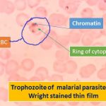 Trophozoite of Malarial parasite