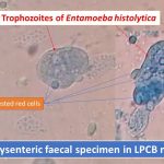 Trophozoites of Entamoeba histolytica in LPCB mount