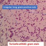 Turicella in gram stain