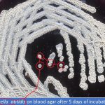 Turicella on blood agar showing donut colony