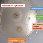 Use of V disk, X disk and XV disk for Haemophilis influenzae identification