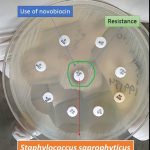 Use of novobiocin disk