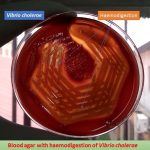 Vibrio cholera on blood agar showing haemodigestion