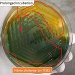 Vibrio cholerae on TCBS agar after prolonged incubation