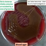Vibrio cholerae on blood agar