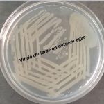 Vibrio cholerae on nutrient agar