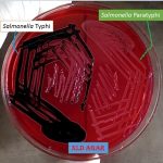 XLD agar with salmonella