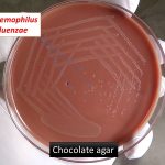 chocolate agar