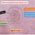 egg of Hymenolopsis nana in saline wet mount