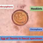 egg of Taenia in faecal specimen