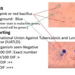 AFB staining
