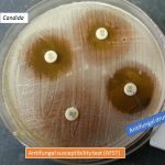 Antifungal drugs and its susceptibility test