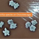 Bacillus species on Chocolate agar