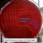 Beta hemolytic colony of Staphylococcus aureus on Blood agar